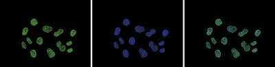 Immunocytochemistry/ Immunofluorescence: Histone H3 [ac Lys9, ac Lys14] Antibody [NBP2-54617]